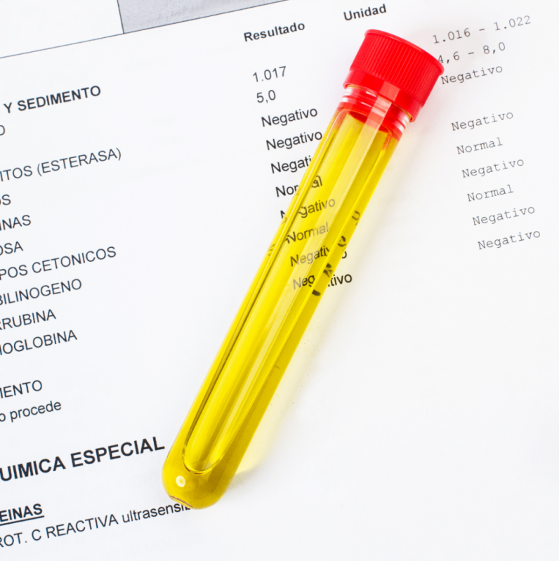 Exame de Urina Veterinário Marcar Itajobi - Exames Laboratoriais Veterinários